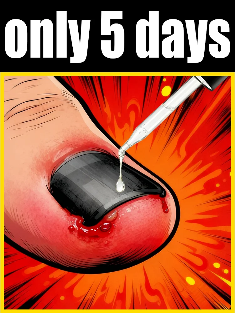 

Say Goodbye to Yellow Dullness, Grow Shiny Nails