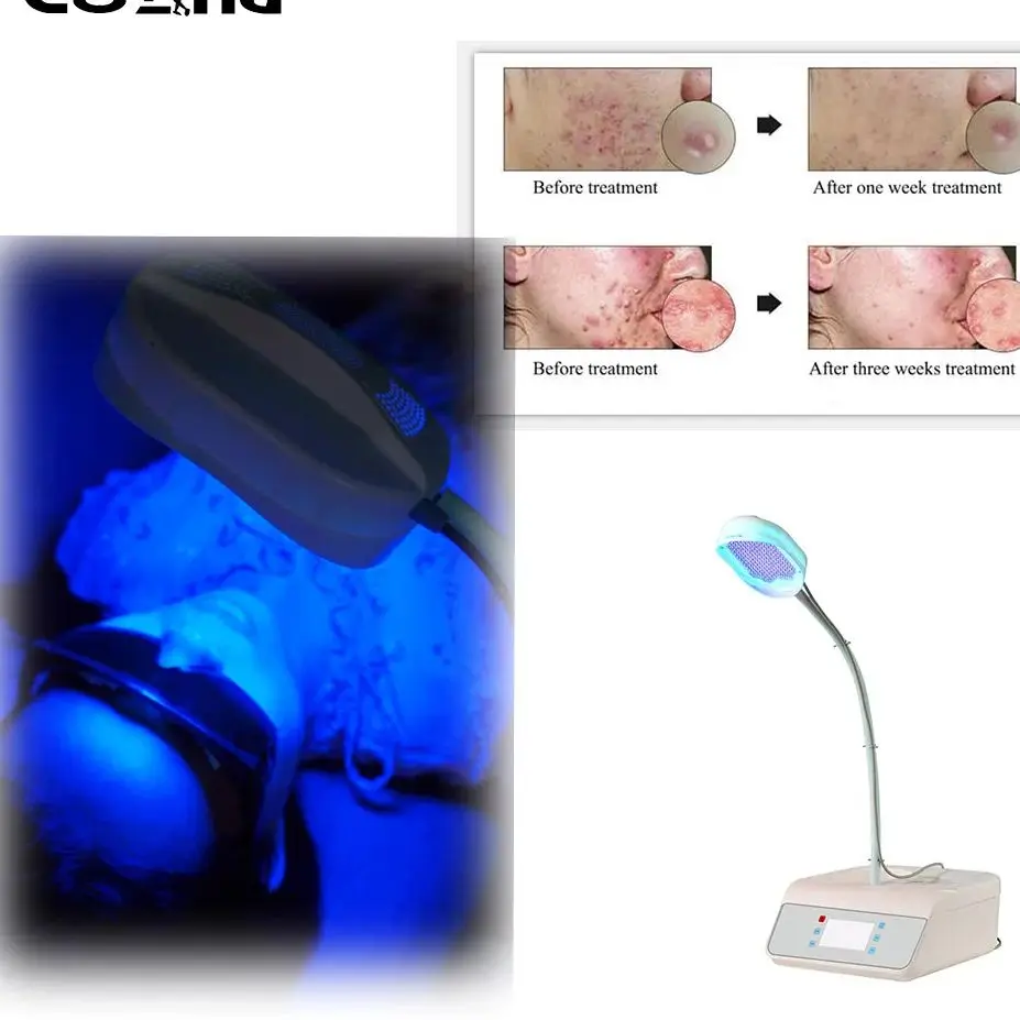 LED Neck and Face Photon Therapy Equipment Red and Blue Light Therapy Acne Removal Wrinkle Beauty Skin Care