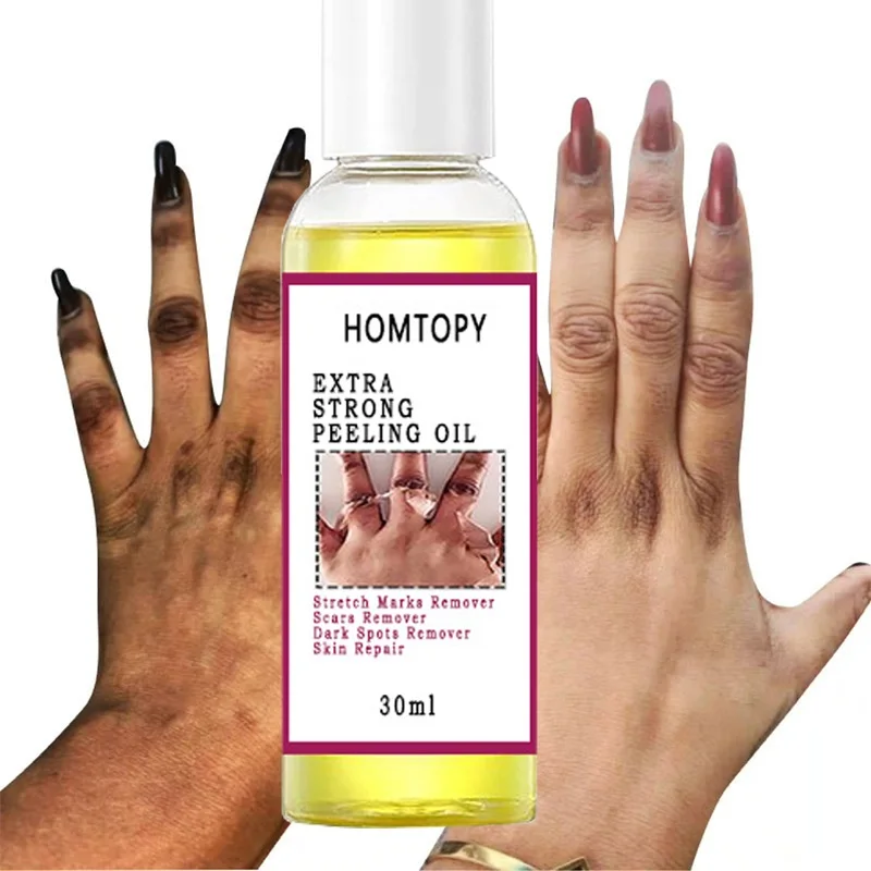 

Yellow Peeling Oil Dark Skin Bleaching Lighten Elbows Knees Hands Melanin Even Skin Tone Whitening Peeling Oil Body Care Serum