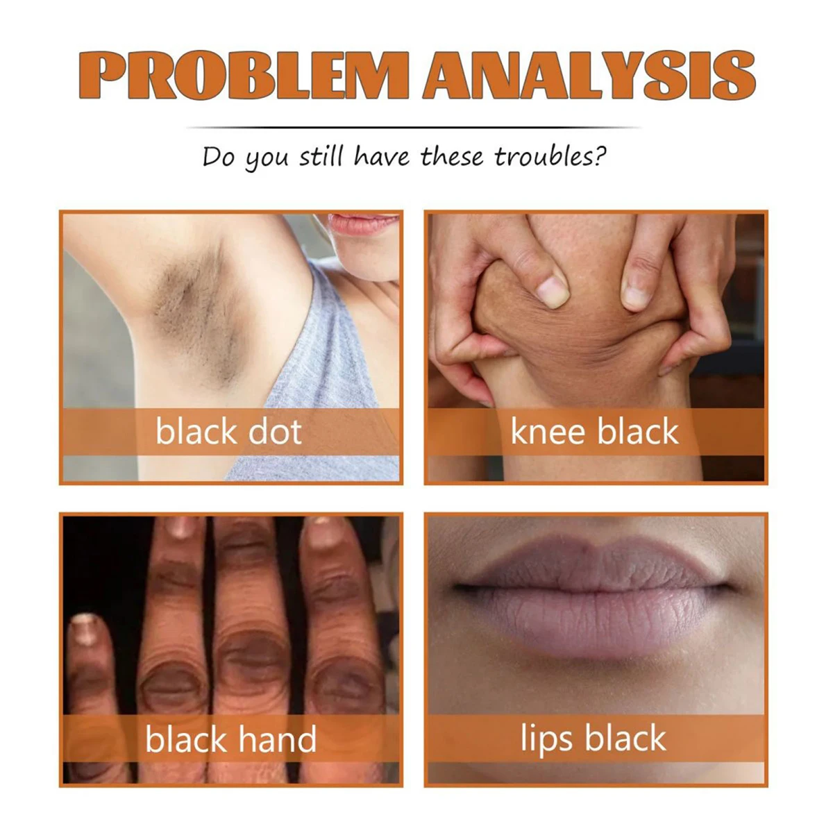 TRSTAY Dark Skin Cream Body Nourishing ไวท์เทนนิ่งโลชั่นสําหรับผิวหยาบหมองคล้ําความชุ่มชื้นลึกข้อต่อหลังเหมาะ