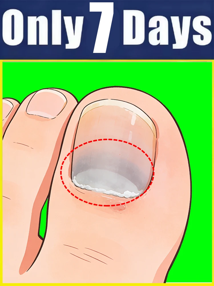 

Инструмент для ухода за собой, 2-е поколение, для решения проблем, устранения тревог и прекращения постоянного беспокойства о проблемах.