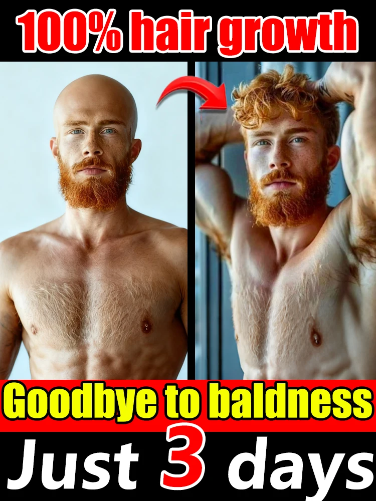 

Hᴀɪʀ sᴘʀᴀʏ, are you ready to shed your ʙᴀʟᴅ ʜᴇᴀᴅ ᴀɴᴅ ᴇᴍʙʀᴀᴄᴇ ᴛʜᴇ ʙᴇst version of yourself