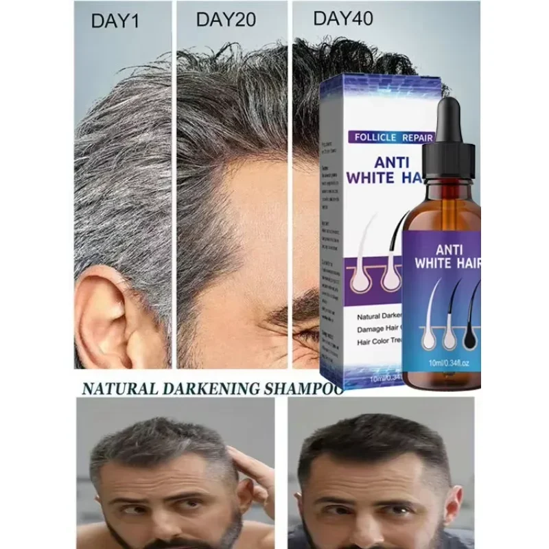 

Gray White Hair Treatment Serum Liquid White To Black Natural Color Repair Nourishessence Anti-gray Anti Loss Care Men Women