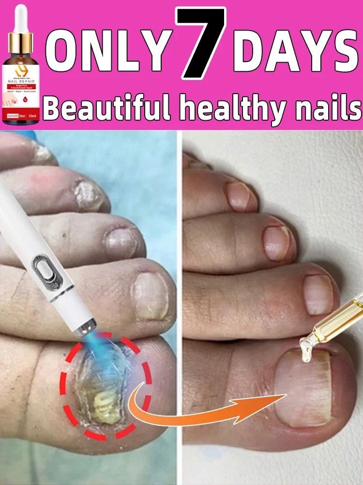 Solves All Nail Problems