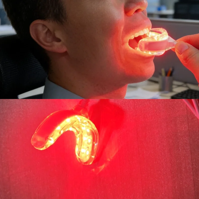 Periodontitis and Gum Disease Laser Treatment, Red Light Therapy Device for Toothache Swelling Relief