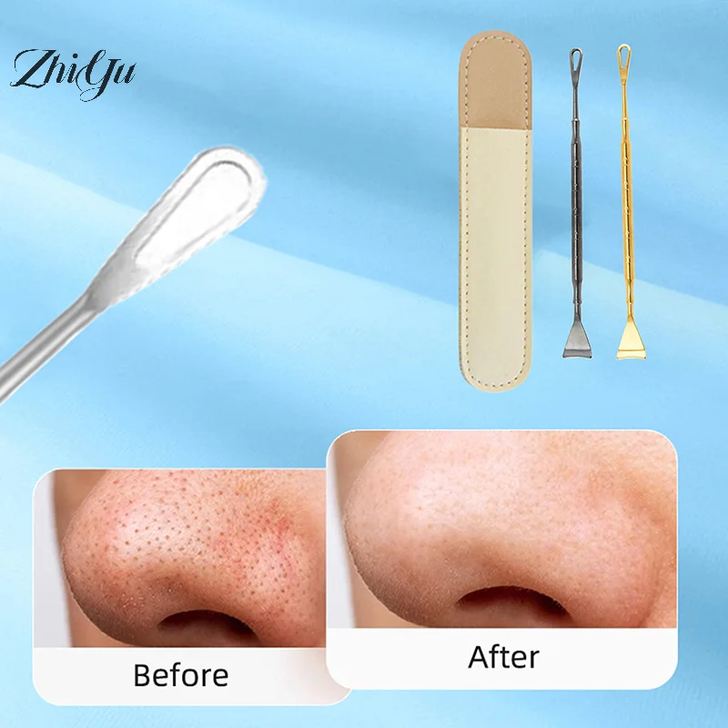 1 stks Comedondrukker Puistje Popper Tool Acne Naald Verwijderen Behandeling Whitehead Popping Zit Neus Gezicht Smet Extractor Tool