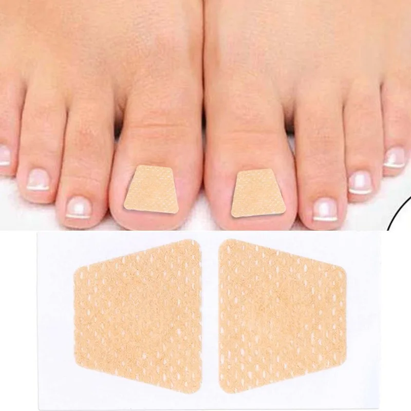 نام أظافر تو تصحيح ملصقات لاصق القدم مصحح باديكير قدم أدوات الرعاية الصحية منصات علاج الداحس الناعمة