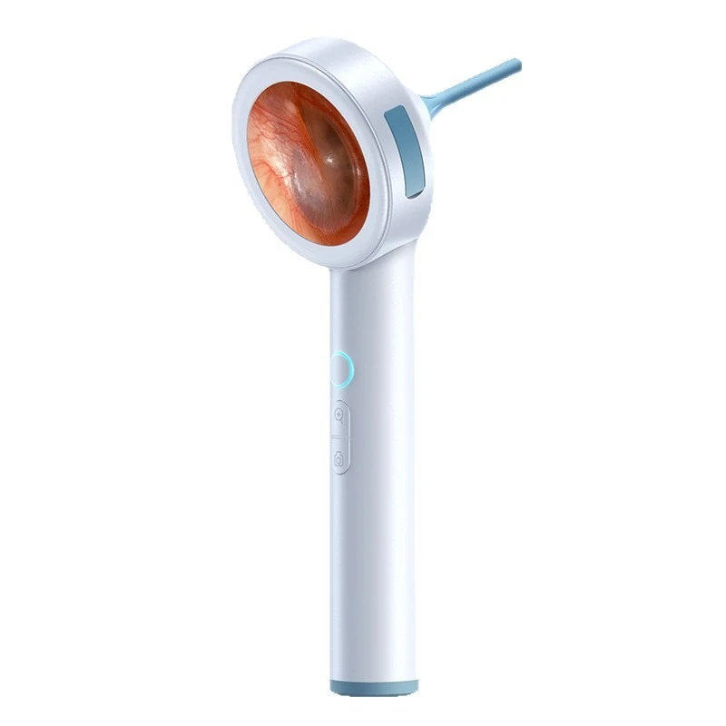 

New high definition otoscope personal care smart screen display detector pet observation mirror