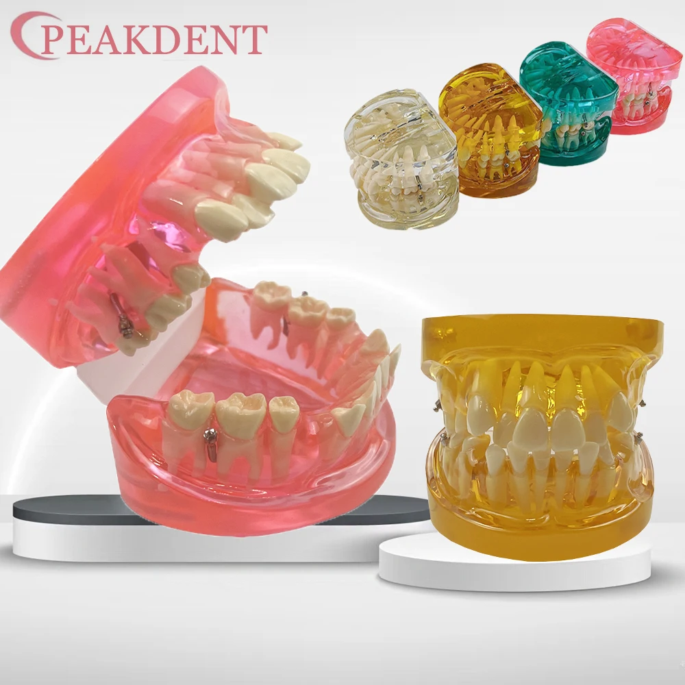 

Модель зубов для ортодонтического лечения, модель для исследования из смолы, модель для коррекции мелкоклюзии, модель Typodont для изучения общения стоматолога