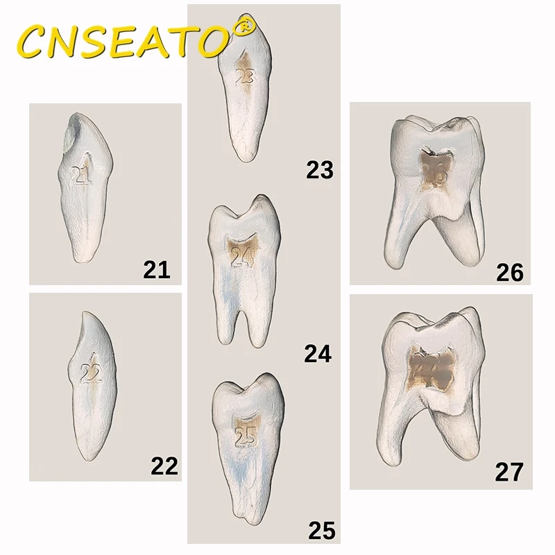 1 szt. Półprzezroczysty stomatologiczny model zębów do ćwiczeń kanałów korzeniowych do treningu endodontycznego badanie zębów wymień żywicę