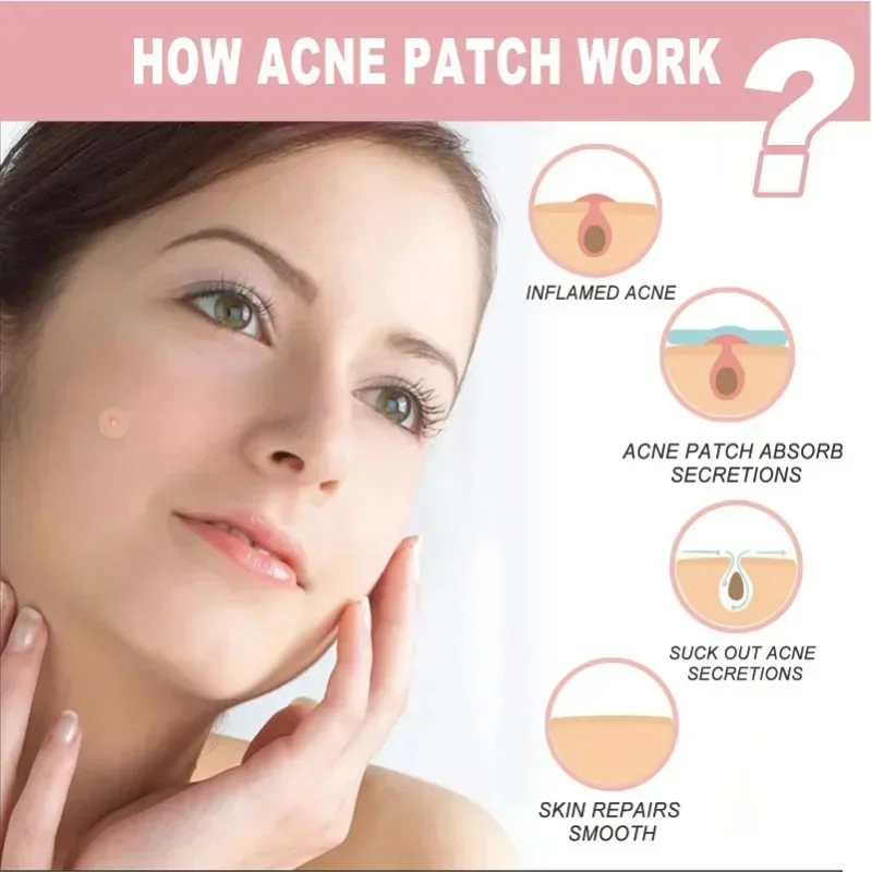 72/180pcs Hydrocolloid Acne Patch Waterproof Acne Removing PU Film Face Printing Spots Marks Invisible Acne Cleansing Patch New