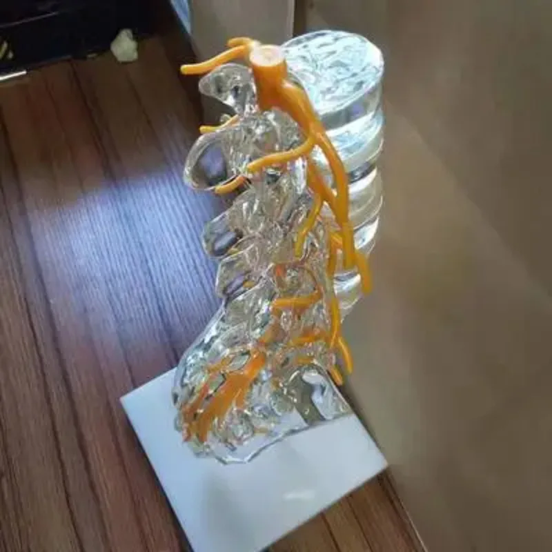 Transparent Lumbar Spine Anatomy Model with Sacrum Coccyx Intervertebral Disc Spinal Nerve 3D Orthopedic Teaching