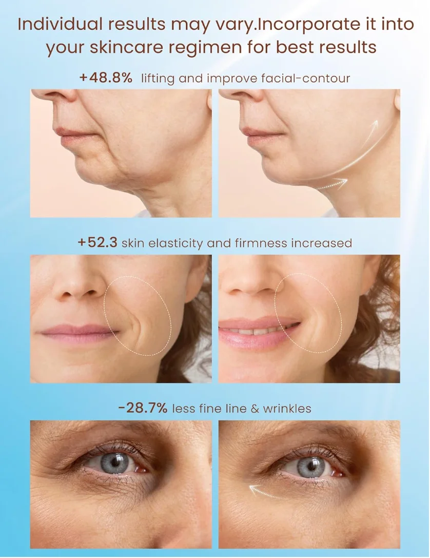 高周波フェイシャルケアマシン USB 目元引き締め しわ除去 フェイスリフティングマッサージャー ボディニキビケア美容機器