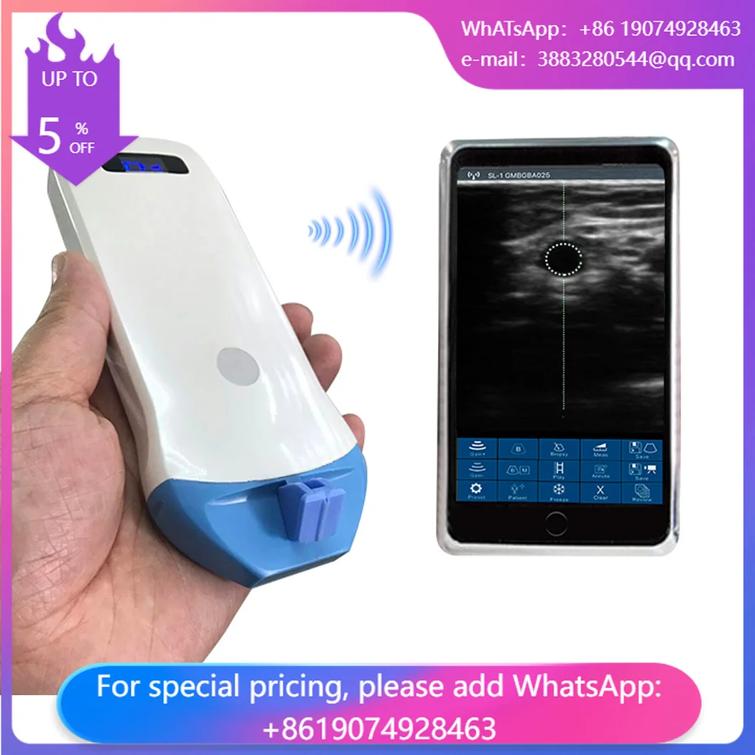 UProbe-5P Portable Wireless Linear UHF Palm B/W Ultrasound Scanner Hospital Equipment Linear Scanner Machine Scanner