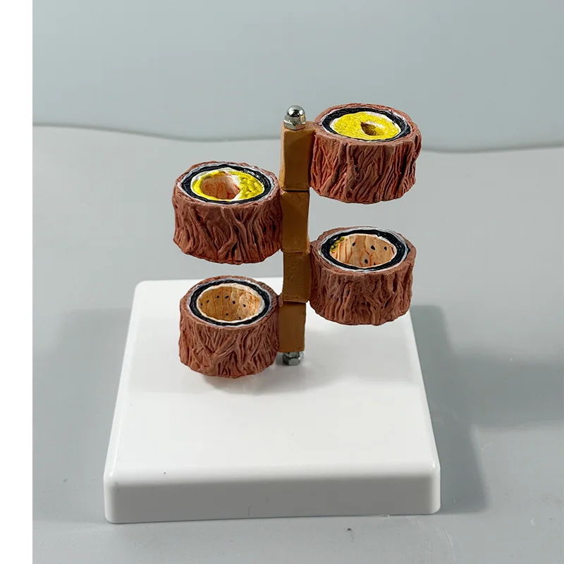 Anatomical Model of Human Branch Atherosclerosis Thrombosis, Suitable for Hematological Vascular Model LYA-002