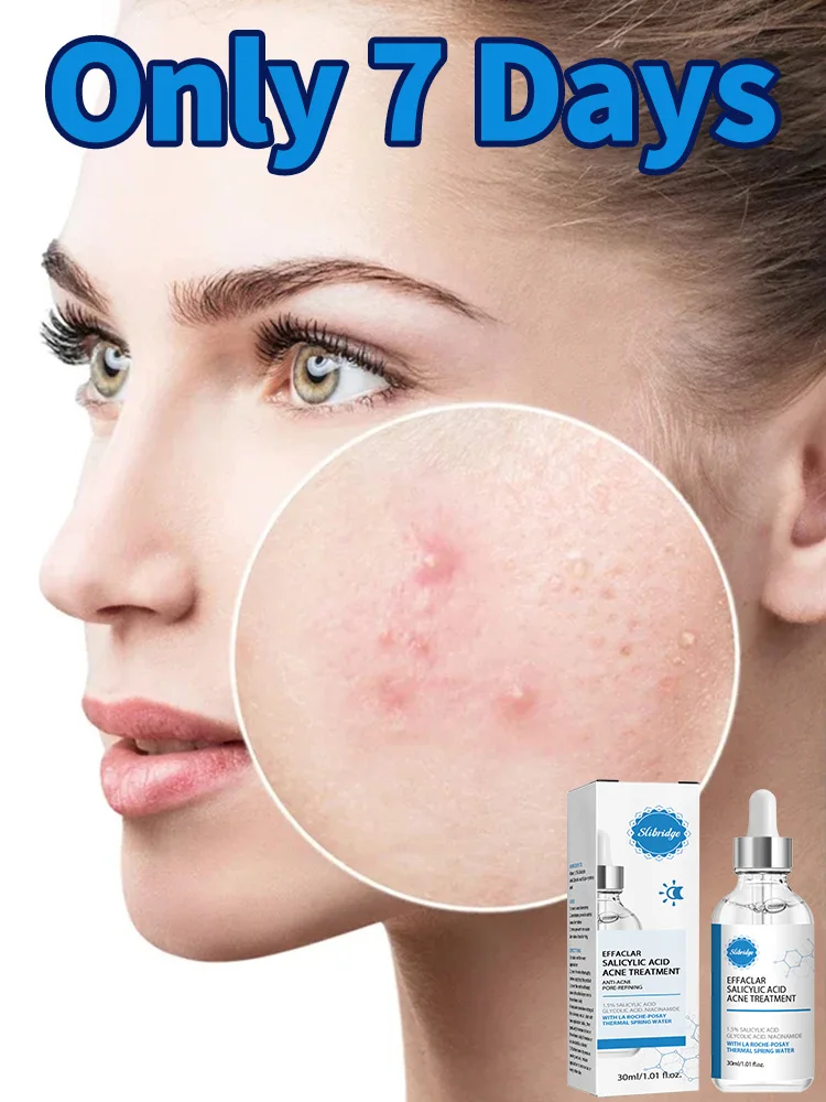 

Solve All Skin Problems Suitable For All Ages