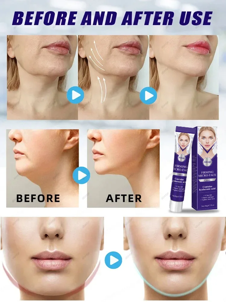 Slimming Face Cream V-Shape Double Chin Fat