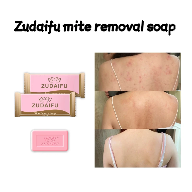 20/30Pc Zudaifu Skin Beauty Soap 7g Deep Cleaning Oil Control Full Body Hand Bath Care Removing Mites Travel Soap