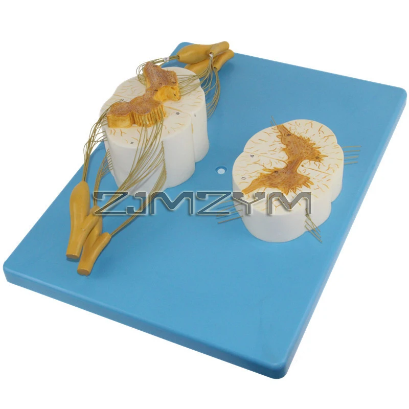 نموذج تشريحي للعمود الفقري البشري الموسع 5 مرات مع حبل العمود الفقري العصبي مع فروع الأعصاب وسائل طبية #3