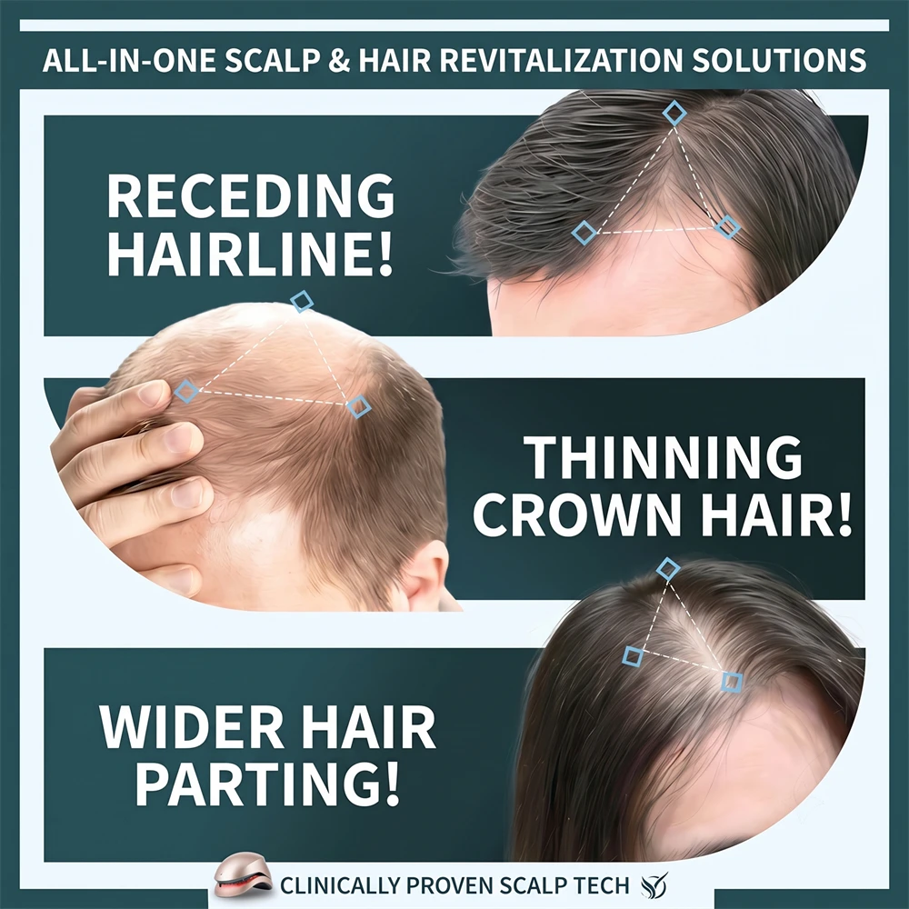 Capacete de Terapia a Laser LL - Hair Care Wella avaliação e preço
