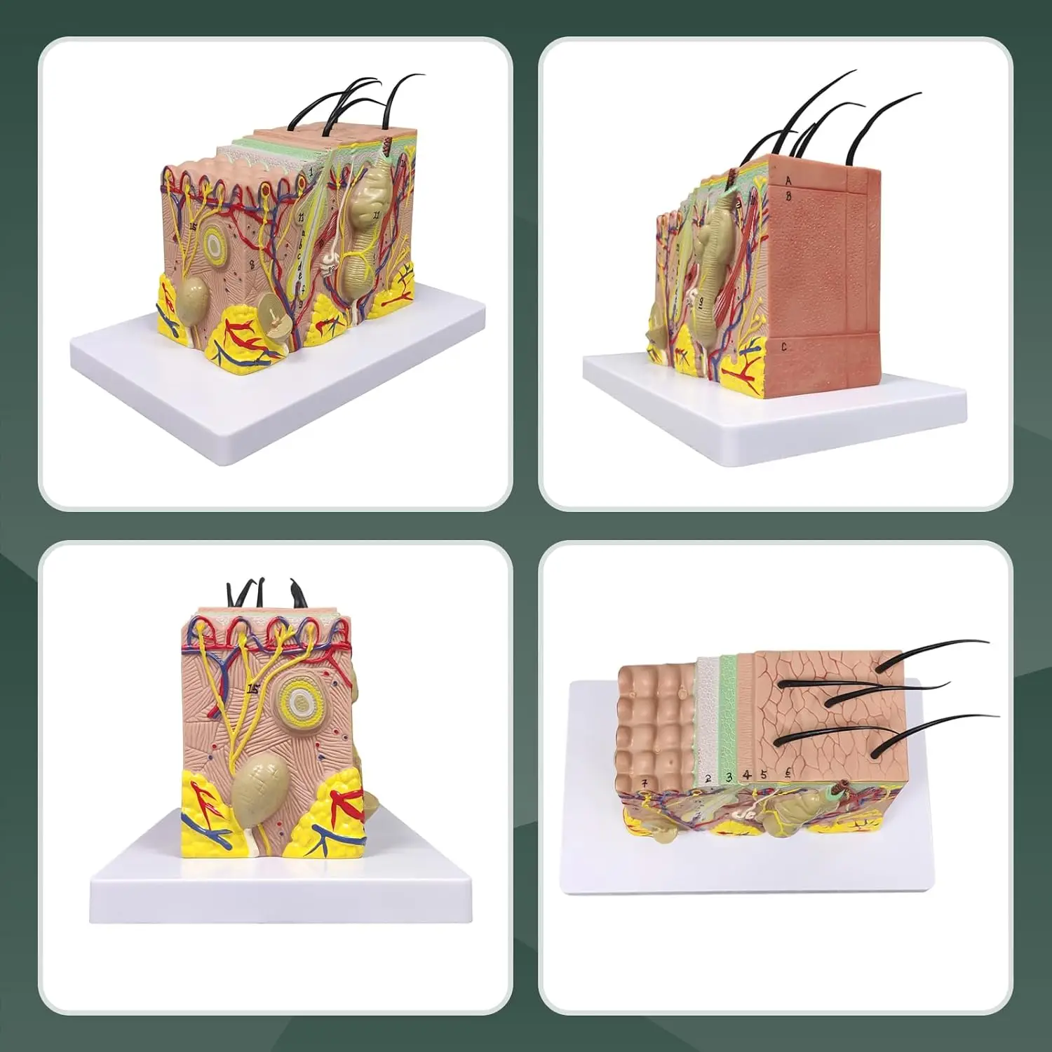 Ultrassist Skin Anatomy Model 35X Enlarged Skin Anatomical with Study Guide Teaching Tool for Science Study & Patient Education