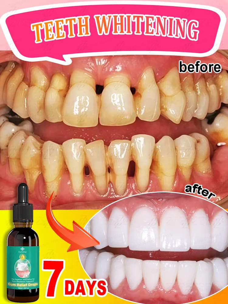 

Pʀᴇᴍɪᴜᴍ ᴏʀɢᴀɴɪᴄ ɢᴜᴍ ᴏɪʟ: Eғғᴇᴄᴛɪᴠᴇʟʏ sᴏᴏᴛʜᴇs sᴇɴsɪᴛɪᴠɪᴛʏ, ʀᴇᴠᴇʀsᴇs ɢᴜᴍ