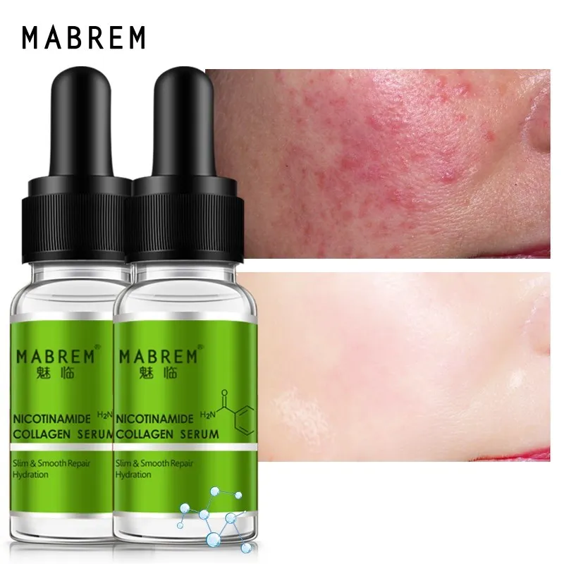 MABREM Niacinamide Essence Whitening Moisturizing Brightening Repair Fine Oil Control Acne 2pcs Collagen Peptide Repair Serum