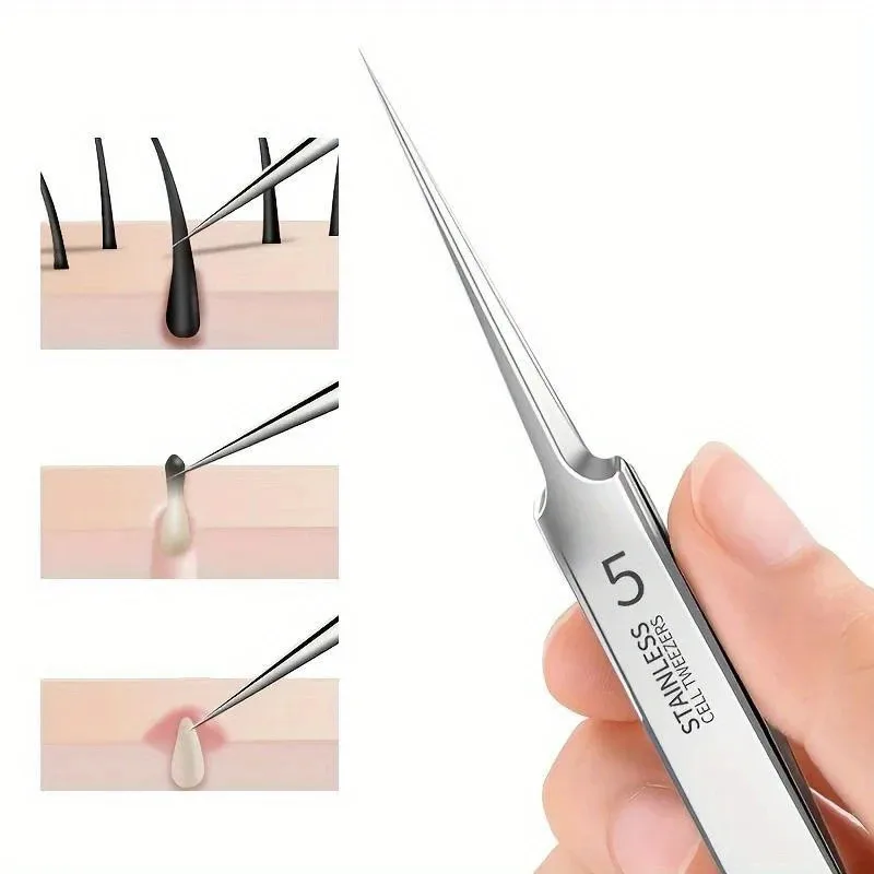 1 paquet extra fin n° 5 pincettes cellulaires pour points noirs d'acné, outils de beauté du visage pour éliminer l'acné, pour les soins de la peau