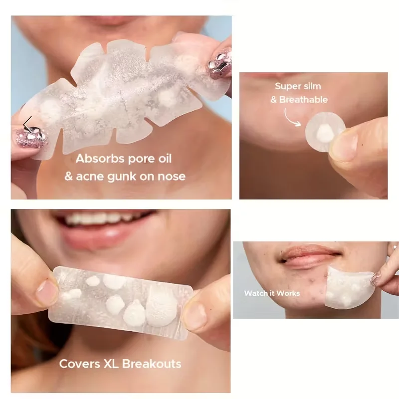 Large Pimple Patches for Face, Hydrocolloid Acne Patches, Variety Shapes Zit Covers, Moon, Strip, Square, Rectangle, Nose Strip image 5