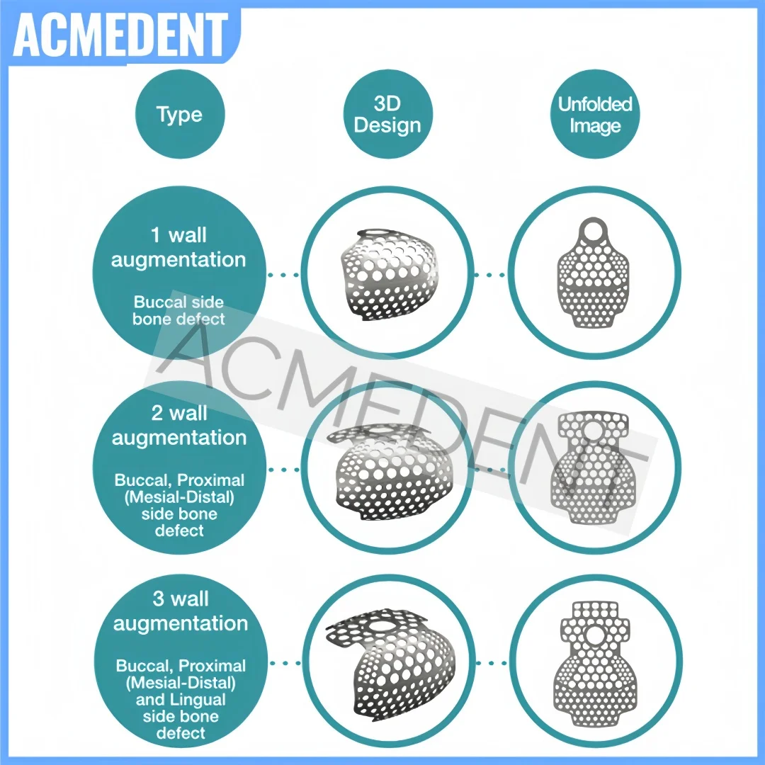 5Pc Dental OB2 GBR 3D Titanium Mesh Guided Bone Regeneration Membrane Plate Implant Bone Formation Bone Incremental SmartBuilder