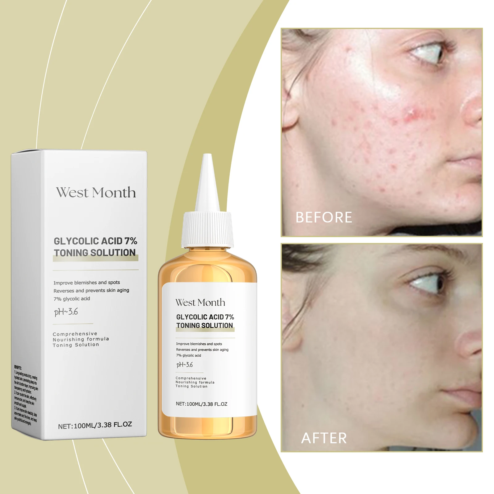 Glycolic Acid 7% Toning Solution Improve Blemishes and Spots reverses and Prevents Skin Aging Moisturizing Toner