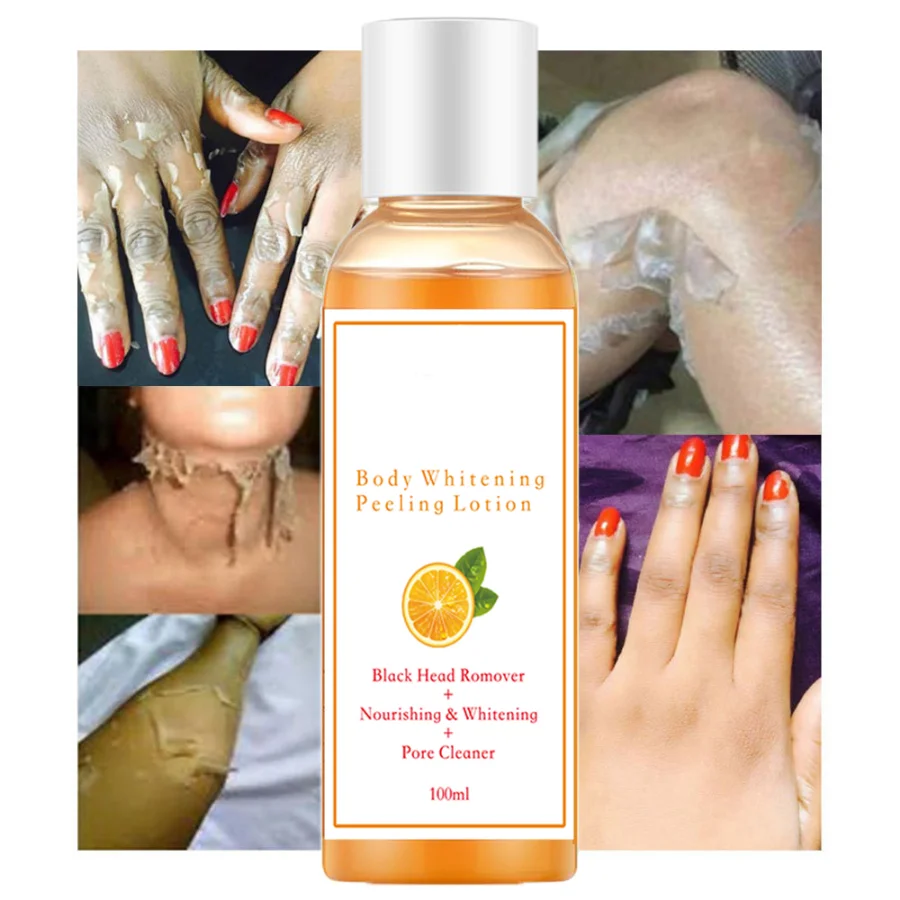 

100ml Orange Peeling Oil Knuckles Whitening for Remove Dead Skin Exfoliating New Skin Anti Dark Spots Oil Corrector Turmeric