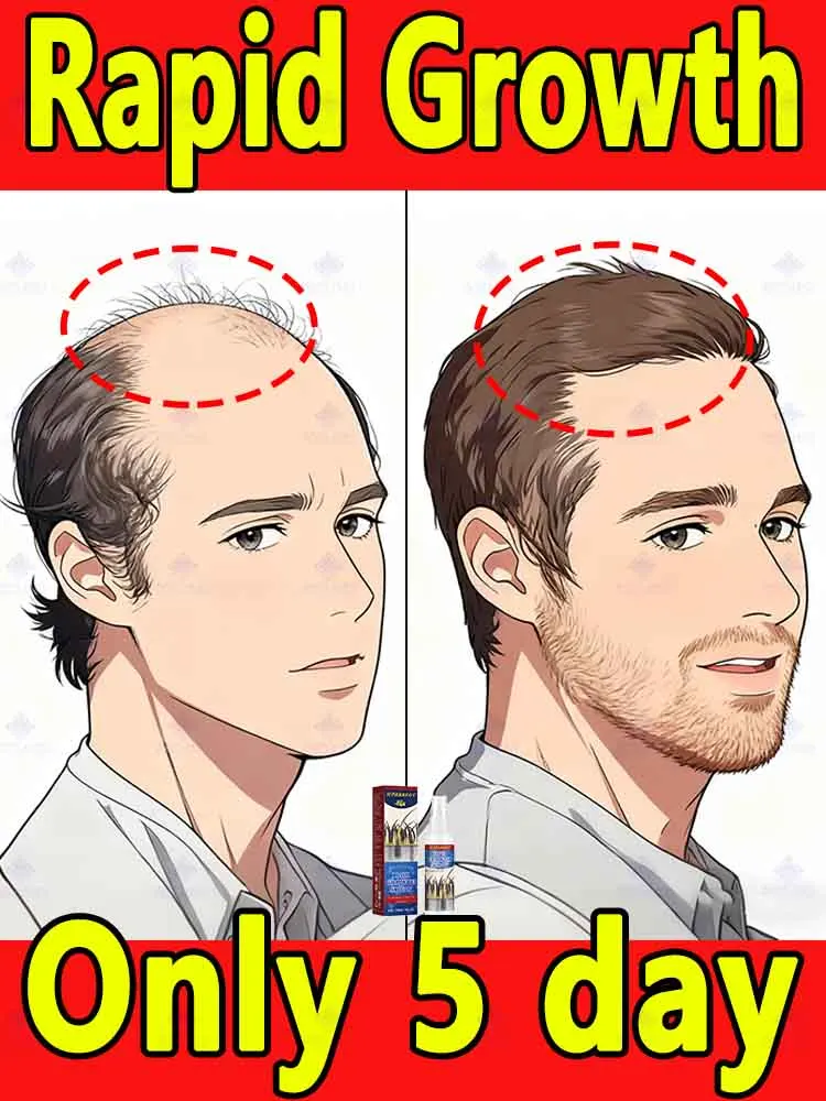 

Средство для кожи головы для тех, кто устал прикрывать ее.