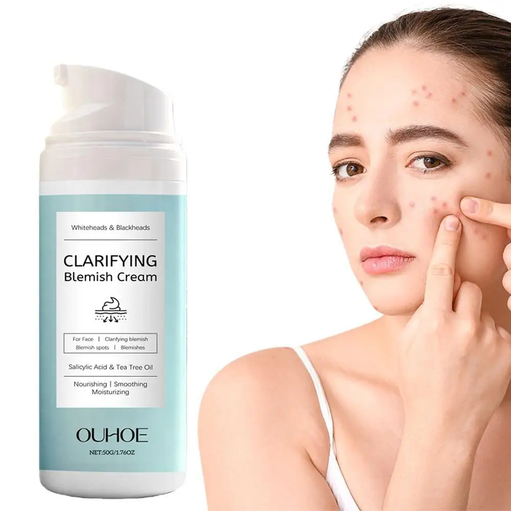 Salicylic Acid Facial Cream for Acne Prone Skin Oil Control Soothing Lightweight Non Greasy Moisturizer for Combination Skin