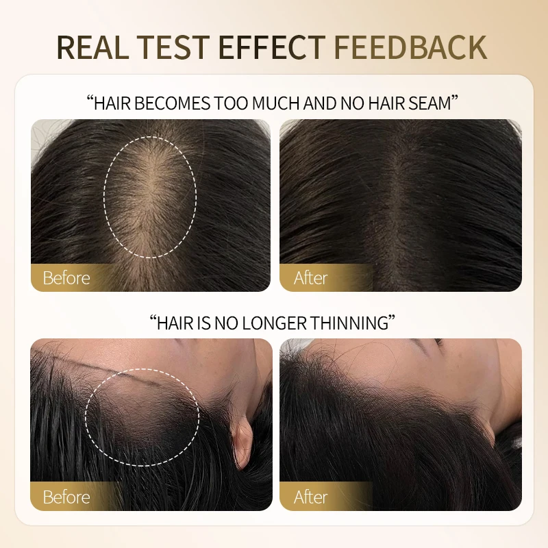 Hair Regrowth Serum Kit Anti Hair Loss Treatment Prevent Baldness Strengthen Roots Fast-Absorbing Non-Greasy Scalp Care Essence