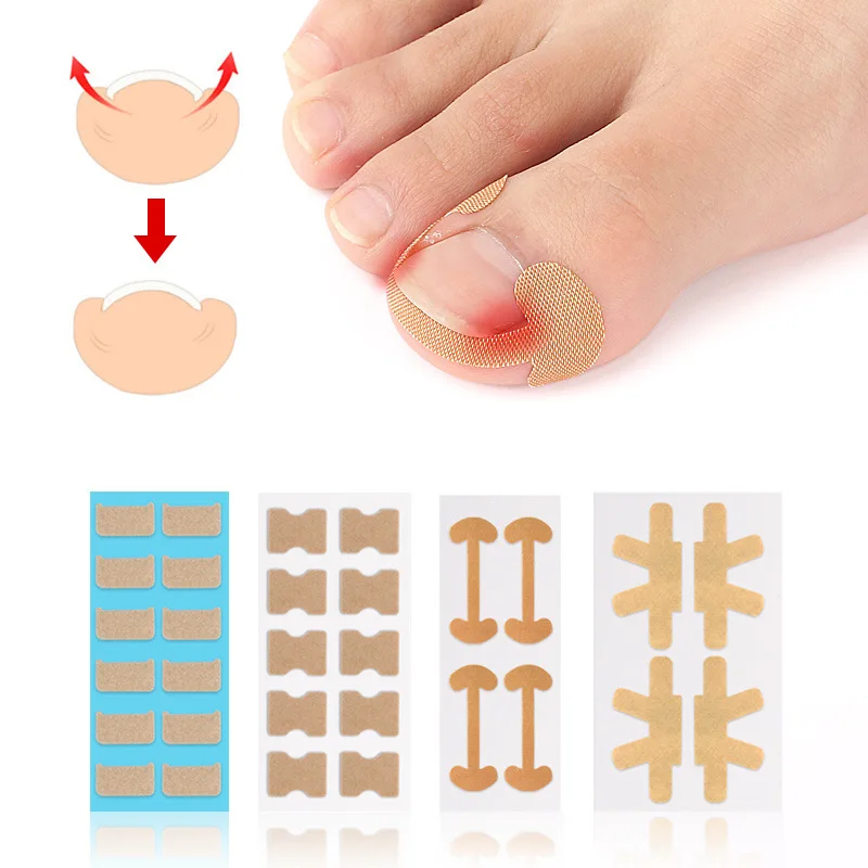 Parche 4/10/12 pegatinas para uñas que mejoran la elasticidad de la uña encarnada, parche corrector de uñas autoadhesivo, parche Corrector de uñas de los pies integrado