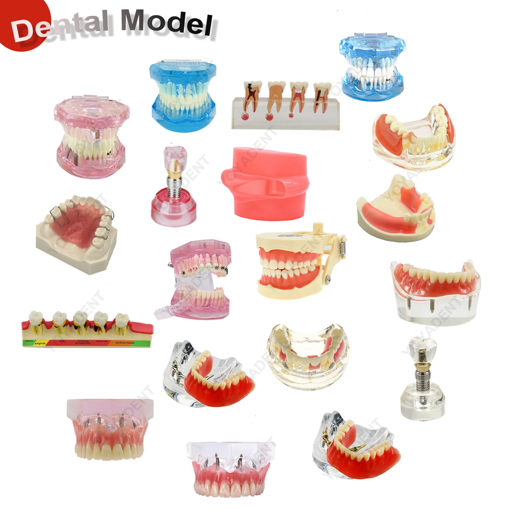 

Различные типы зубной модели, имплантат/ортодонтический/фериодильный/реставрация/тректировка, оральная модель для изучения стоматологических изделий, демонстрация