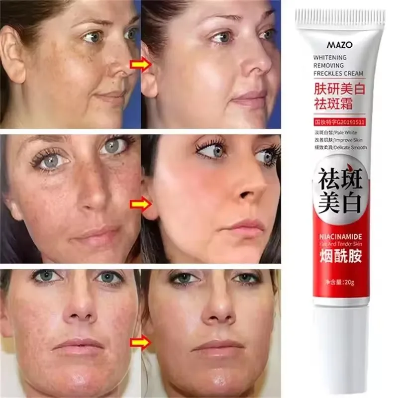 Powerful Spot-Removing Whiten Cream Brighten Skin Fast Eliminates Melanin Pigmentation Melasma Dark Spots Korean Skin Care 20g