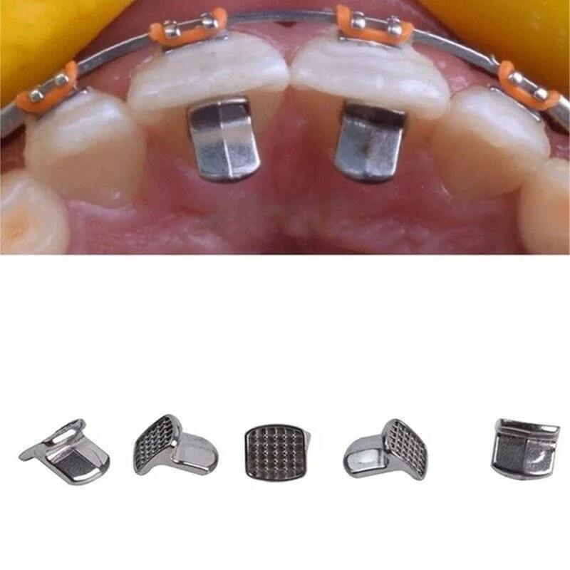 10pcs Orthodontic Tongue Corrector Orthodontic Tongue Tail Single Block Bite Device Single Wing Generator Adhesive Hinge Nail