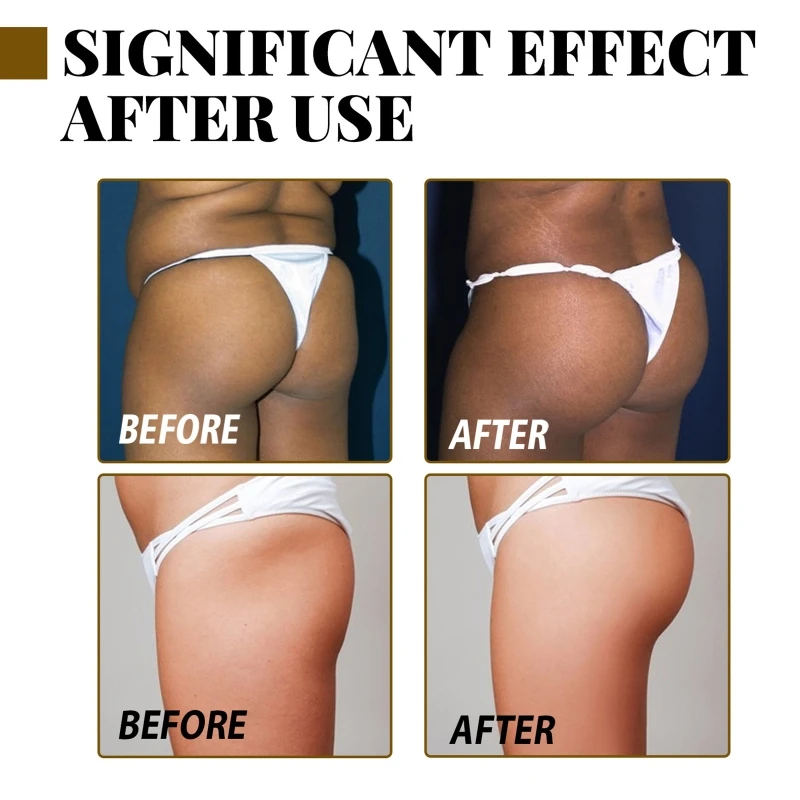 1 Bottle Sexy Hip Buttock Enlargement Cream,Effective Shaping Firming Buttock,Hip Lift Up Butt Enlargement Essential Oil