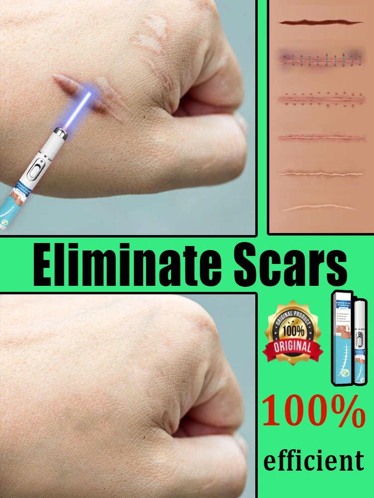 Scar products