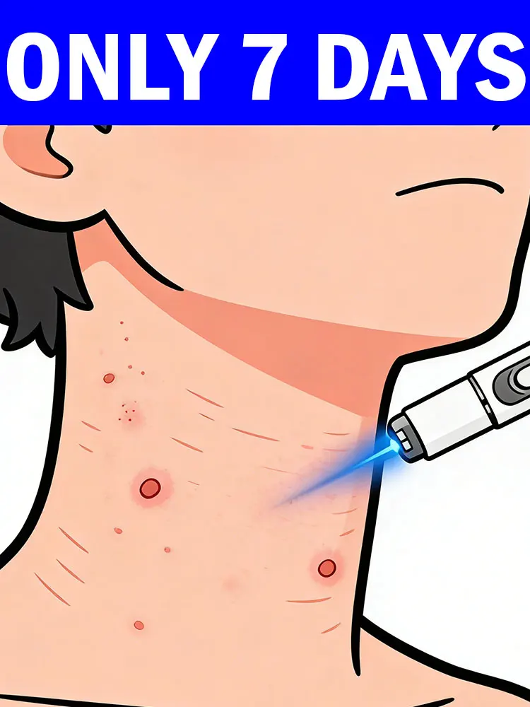 

Удаление пигментации со скоростью света, обеспечивающее безупречную кожу, очищающий инструмент.