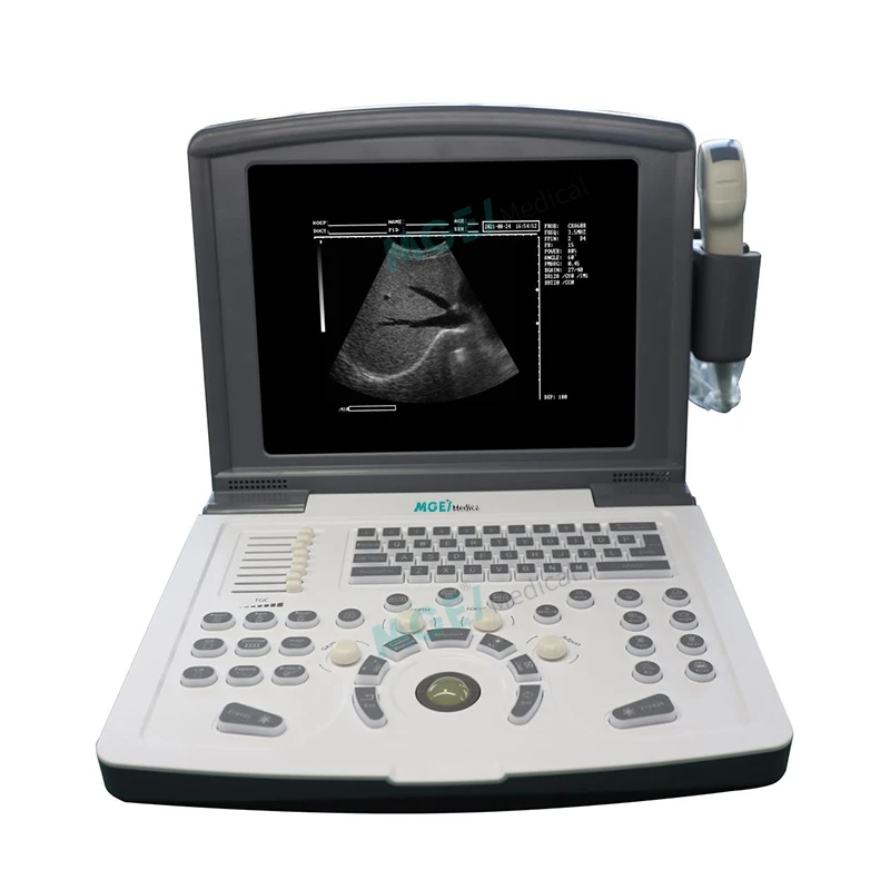 

MEDIGE UMKR12 China Good Price Hospital Clinic Laptop Ecografos Instruments Black White B/W Ultrasound Machine Portable