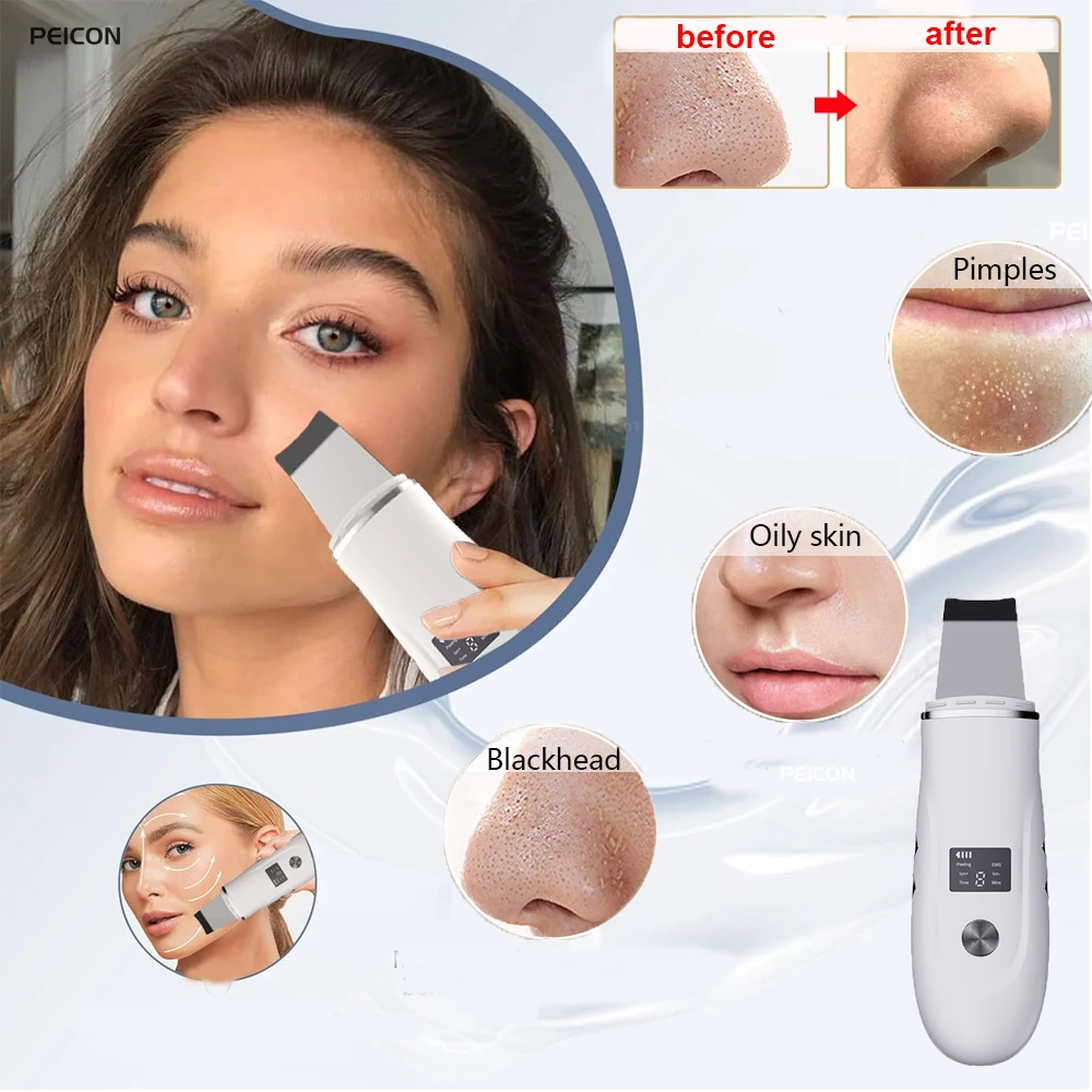 Spatule ultrasonique pour le visage, soins pour la peau, dissolvant de points noirs, épurateur ultrasonique pour la peau, soins en profondeur du visage, spatule de nettoyage du visage