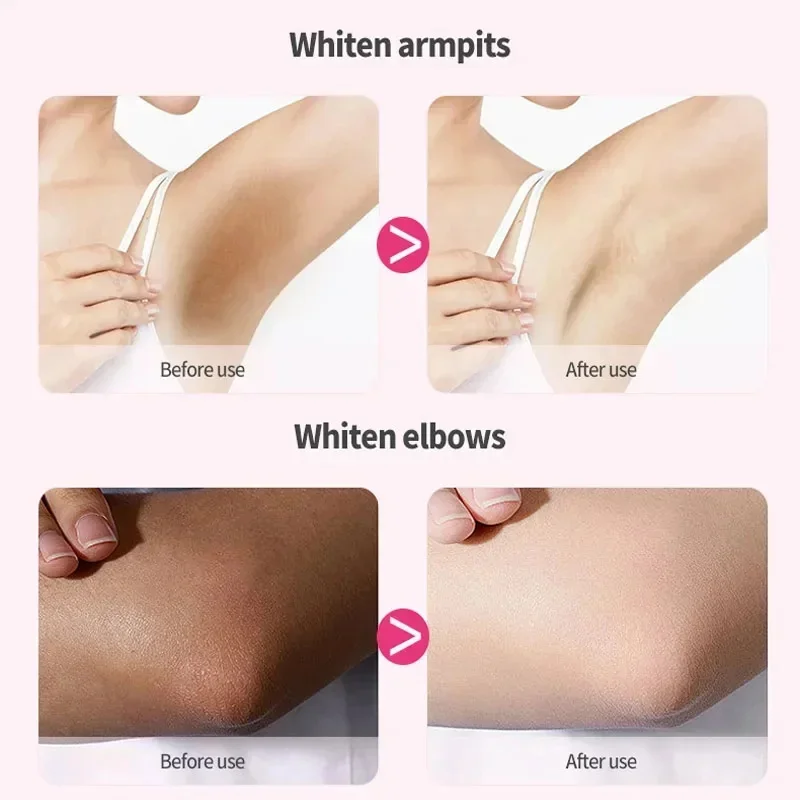 Creme de clareamento para partes íntimas, Branqueamento das axilas, Bunda, Joelho Clarear, Coxa interna, Peças escuras íntimas, Remover o cuidado da melanina