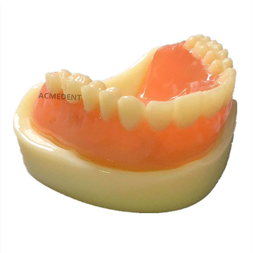 Dental pełna proteza Model Overdenture magnetyczne mocowanie górne badanie żuchwy