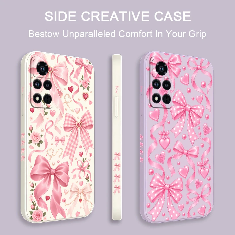 Bow Knots Flower Phone Case For Honor 600 Pro 400 70 Lite 500 200 90 Smart 50 SE 20 9C 9X Pro Shockproof Silicon Soft Cases Etui