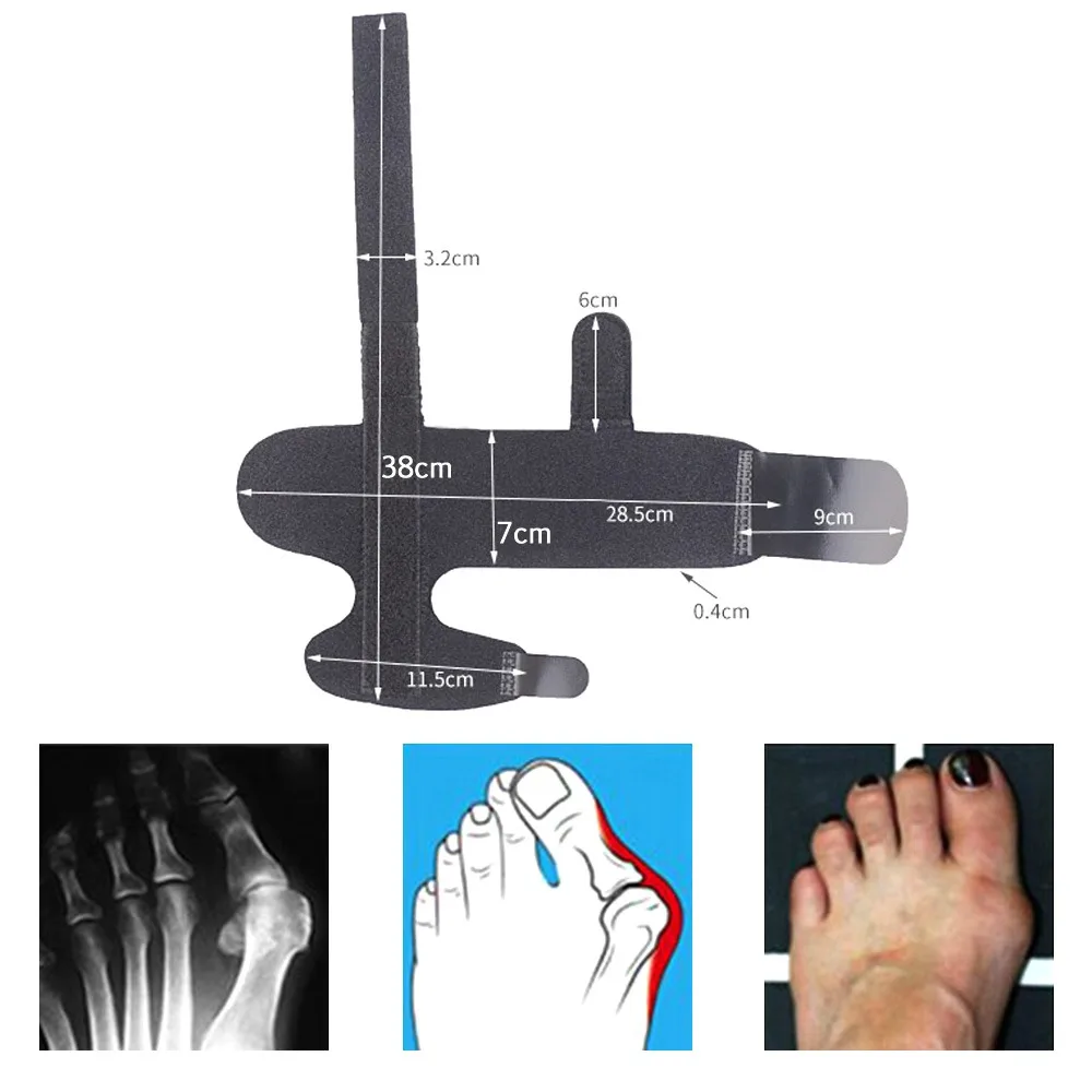 Hallux Valgus Bunion Corrector Splint Straightener Support Toe Foot Thumb Orthosis Orthopedic Tools 1 Pair for Home Daily Use