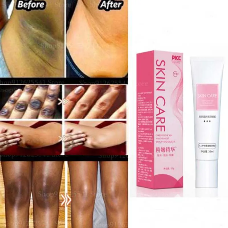 Body Whitening Cream Intimate Area Pink Essence Private Parts Underarm Bleaching Serum Knee Butt Dullness Brighten Lip