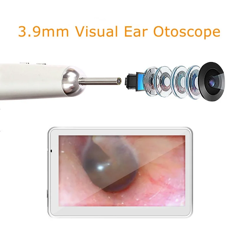 3.9MM Digital Otoscope 1080P Ear Cleaning Endoscope Earwax Cleaning Tool Ear Spoon with 7 Inch LCD Screen 6 Led Adjustable Light